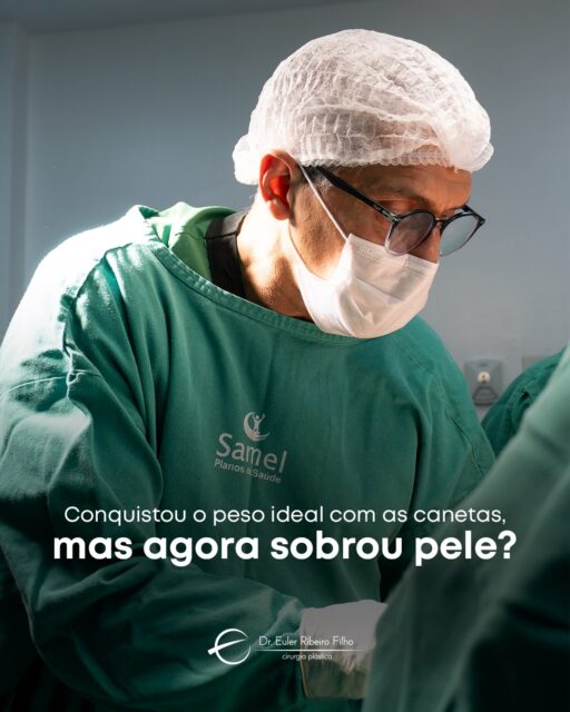 Perder peso é uma conquista. Se adaptar ao novo corpo também faz parte do processo.

Com a perda significativa de peso, é comum que algumas regiões apresentem excesso de pele e flacidez, especialmente quando o emagrecimento acontece de forma rápida.

Nesses casos, a cirurgia reparadora pode ser uma aliada para melhorar o contorno corporal e adequar os tecidos ao novo momento do corpo.

Dr. Euler Ribeiro Filho
CRM 4501/AM | RQE 1477
Cirurgião Plástico
