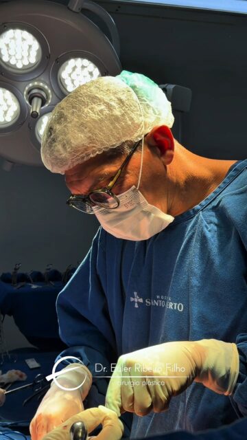 Abdômen clássico com lipoescultura exige planejamento, estrutura e acompanhamento em cada etapa.

Do pré ao pós-operatório, o cuidado é realizado por uma equipe com mais 9 profissionais, sempre com foco em segurança, qualidade e atenção individualizada.

Cirurgia plástica é resultado, mas também é confiança em todo o processo.

Dr. Euler Ribeiro Filho
CRM 4501/AM | RQE 1477
Cirurgião Plástico